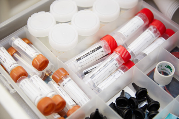 A photo showing a selection of sample bottles